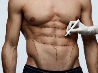 Abdominal Etching et obésité : pourquoi cette chirurgie ne convient pas