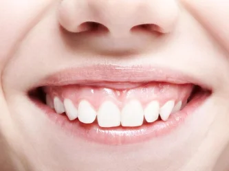 Sonrisa gingival: causas, opciones de tratamiento y corrección en Turquía