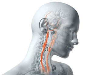 ما الفرق بين السكتة الدماغية النزفية والاحتشائية؟ دليل طبي شامل