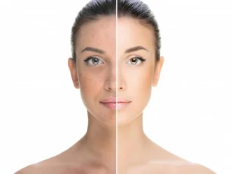 Taches brunes sur le visage : tous les traitements qui fonctionnent