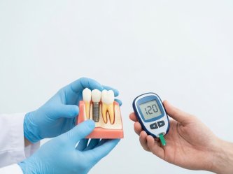Dental implants and diabetes: Risks and conditions