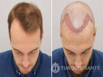 CLINIC HAIR prix pas cher Restauration Capillaire CLINIC HAIR prix pas cher Restauration Capillaire 1