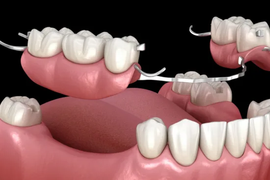 Dental prosthesis