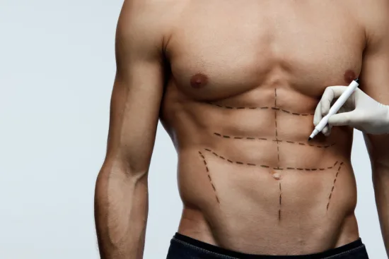 Прорисовка мышц живота (Abdominal Etching) Прорисовка мышц живота (Abdominal Etching)