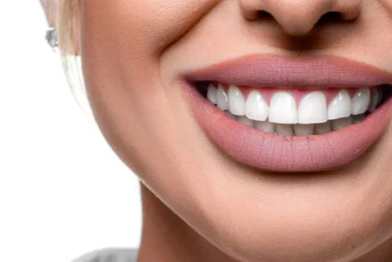 Hollywood Smile