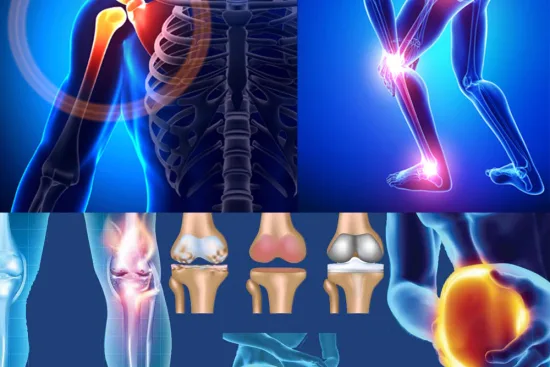 طب العظام