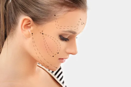 تقنية ذيل الحصان تقنية ذيل الحصان