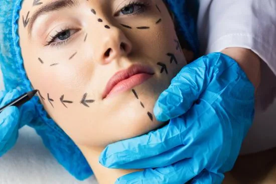 Chirurgie esthétique