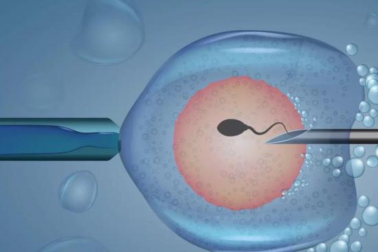 Intracytoplasmic Sperm Injection (ICSI)