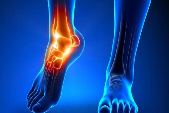 Osteoarthritis treatment Turkey Osteoarthritis treatment Turkey