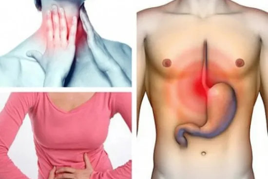 Gastroesophageal reflux disease treatment Turkey Gastroesophageal reflux disease treatment Turkey