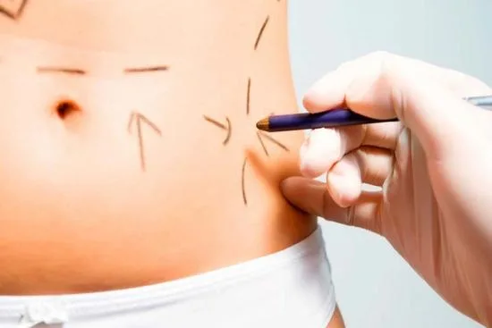 Precio de la abdominoplastia en Turquía Precio de la abdominoplastia en Turquía
