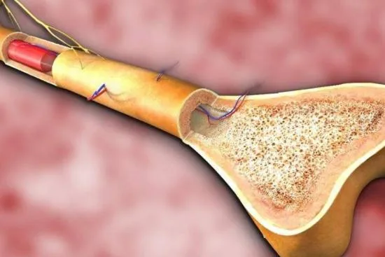 Principales tipos de cáncer de médula ósea 2026