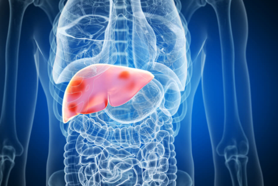 Liver cancer treatment