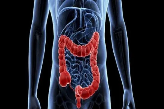 Symptoms of colorectal cancer 2026