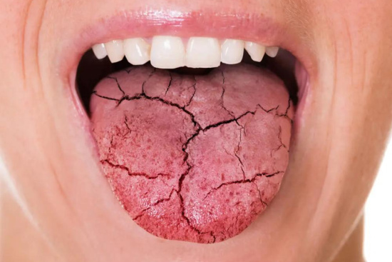 Tratamiento del cáncer de lengua