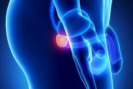 Tratamiento del cáncer de próstata