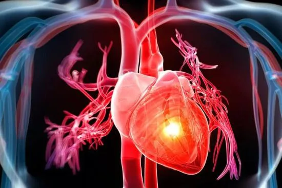 Cardiopathie congénitale Cardiopathie congénitale
