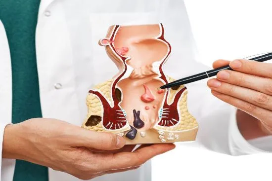 ¿Qué es una fístula anal y en qué se diferencia de un absceso perianal? 2026 ¿Qué es una fístula anal y en qué se diferencia de un absceso perianal? 2026