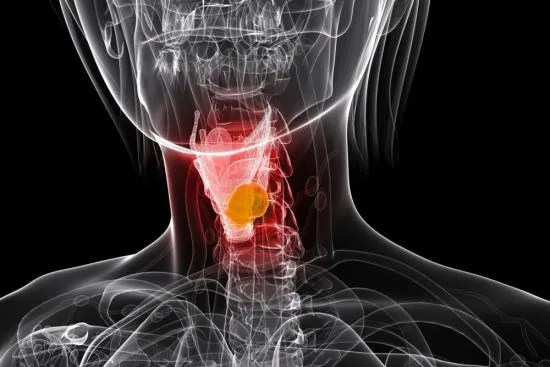 Chirurgie du larynx
