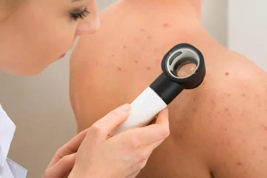 Skin diseases Skin diseases