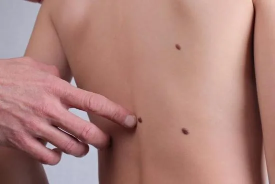 طب الأمراض الجلدية تركيا طب الأمراض الجلدية تركيا