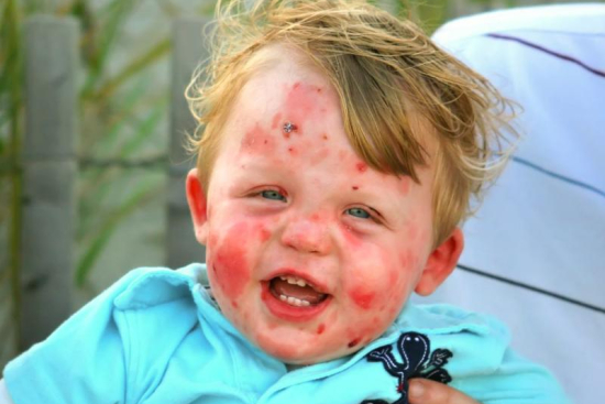 Dermatologie Turquie