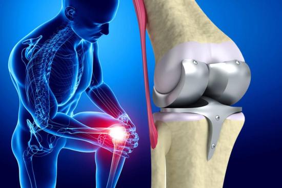 Knee prosthesis