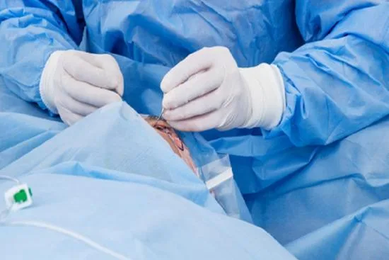 Eye enucleation surgery in Turkey: when is it necessary? 2026 Eye enucleation surgery in Turkey: when is it necessary? 2026