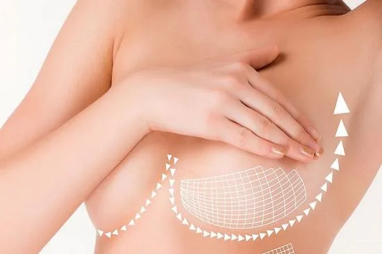 What is nipple cosmetic surgery in Turkey? 2026