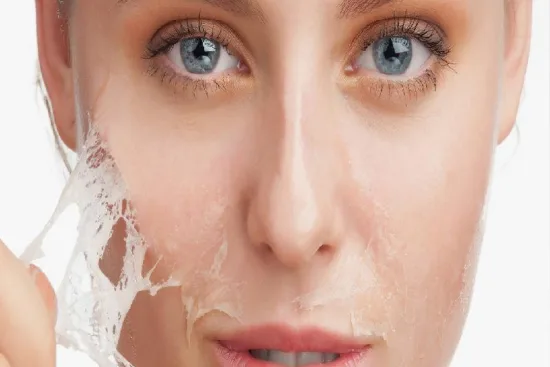 Is a chemical peel right for you? 2026