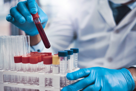 Hématologie Turquie