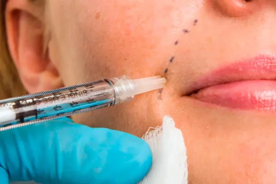 Techniques & types of injectable collagen in Turkey 2026