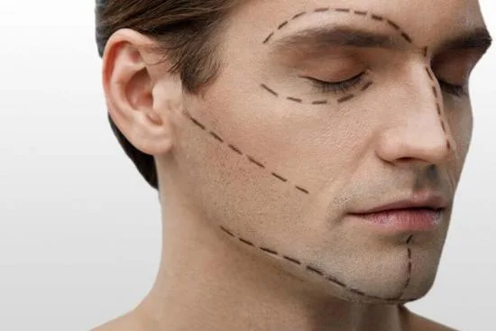 Jawline contouring prix Jawline contouring prix