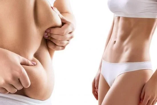 Full body lift surgery in Turkey Full body lift surgery in Turkey