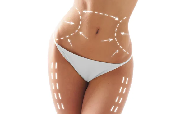 Body lift surgery in Turkey Body lift surgery in Turkey