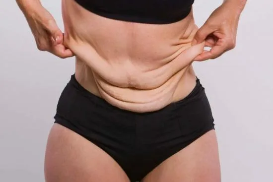 Belt lipectomy in Turkey Belt lipectomy in Turkey