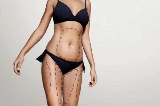 What is 360° liposuction? 2026 What is 360° liposuction? 2026