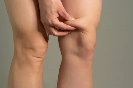 knee liposuction