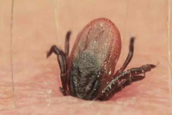 symptômes de la maladie de Lyme 