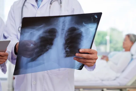 Diagnosis of respiratory diseases in Turkey 2026