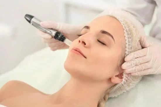 Indications du microneedling : quels problèmes cutanés peut-il traiter ? 2026