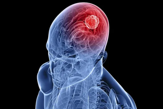 Síntomas comunes que requieren un examen neuroquirúrgico 2026