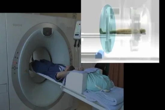What is a PET-Scan or PET-CT? 2026