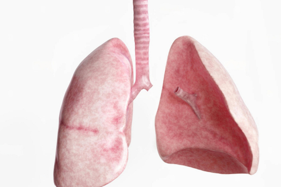Pneumonectomy