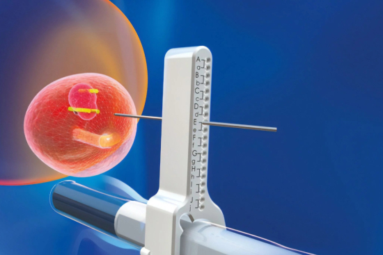 Prostate biopsy