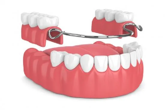 ¿Cuál es el precio de una prótesis dental en Turquía? 2026 ¿Cuál es el precio de una prótesis dental en Turquía? 2026