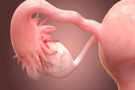 Potential symptoms and complications of ovarian cysts 2026 Potential symptoms and complications of ovarian cysts 2026