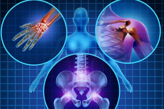Diagnosis of rheumatic diseases in Turkey 2026 Diagnosis of rheumatic diseases in Turkey 2026