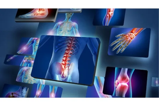 Prevention of rheumatic diseases 2026 Prevention of rheumatic diseases 2026